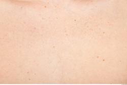 Photo Textures of Human Skin